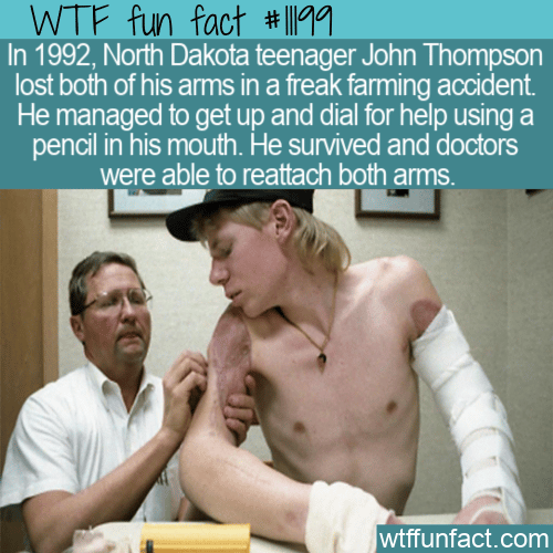 WTF-Fun-Fact-John-Thompson-Lost-Both-Arms-1.png